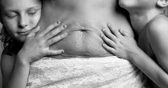 10 фотографий, которые показывают, что тело женщины после родов выглядит совсем не так, как в журналах о беременности