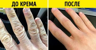 15 фотографий «до» и «после», которые доказывают, что время и немного усилий порой творят чудеса