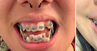 15 доказательств того, что любые зубы можно превратить в идеальную улыбку
