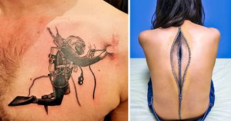 Татуировки превращают шрамы в произведения искусства, которые больше не хочется скрывать