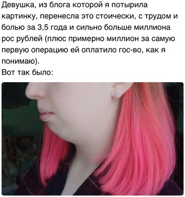 Комментарий с изображением на AdMe.Media