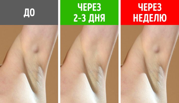 Увеличенные подмышечные лимфоузлы – диагностика причин, лечение в клинике в Москве