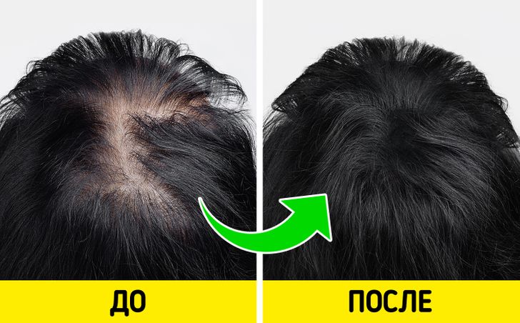 Как отрастить волосы: 14 простых советов, которые точно помогут - Лайфхакер