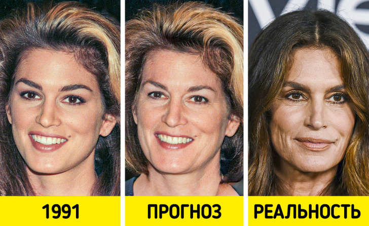 Как выглядели бы 9 знаменитостей без современных бьюти-процедур