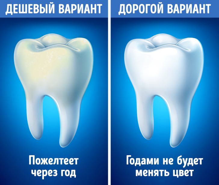 Права пациентов: что делать, если вам некачественно вылечили зубы