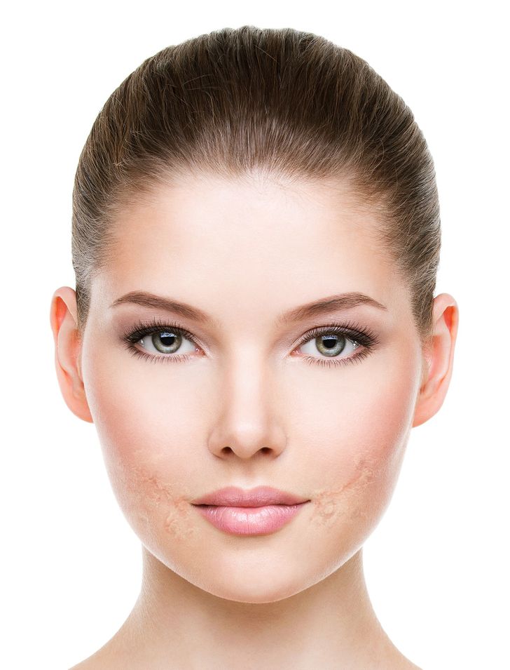 9 продуктов, которые нельзя наносить на кожу лица, по мнению дерматологов /  AdMe