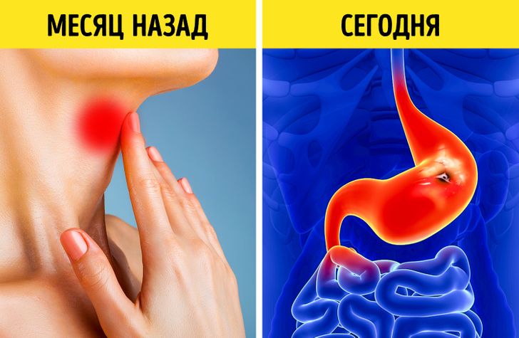 Болит живот после коронавируса, желудок, печень - лечение в Екатеринбурге