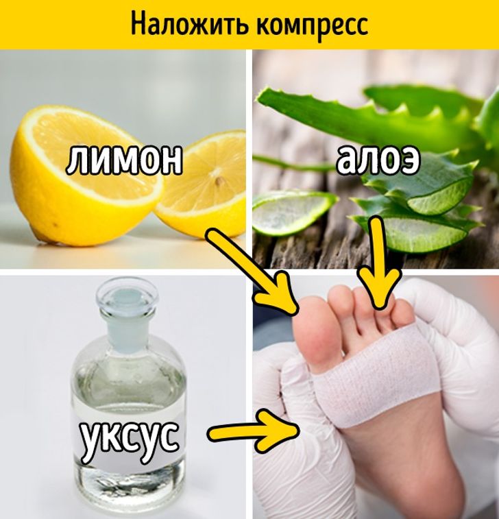 11 легких способов вылечить мозоль от неудобной обуви