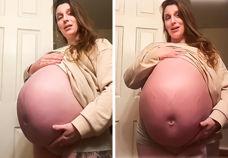 5 недель беременности описание и фото — Евромедклиник 24