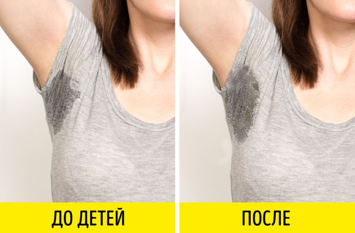 Увеличение груди Киев | Цена | Маммопластика | Отзывы и Фото