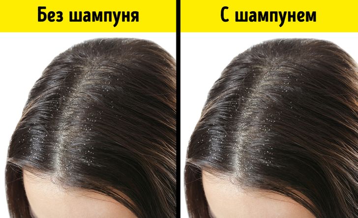 7 продуктов, из-за которых волосы теряют блеск и выпадают / AdMe